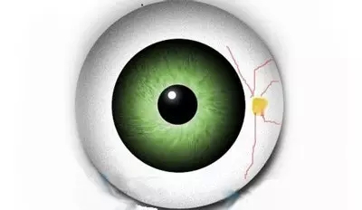 五個小方法 避免視力衰退