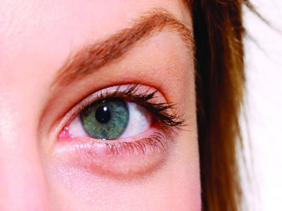 冷敷治療可緩解老人眼睛充血症狀