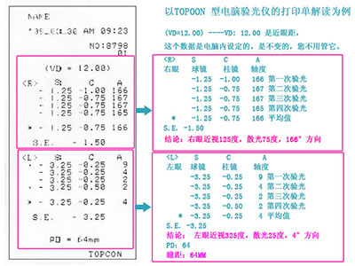 你知道驗光單該如何看嗎？