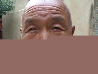 如何做好青光眼日常護理