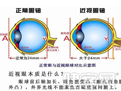 翻白眼保健操效果好不好？