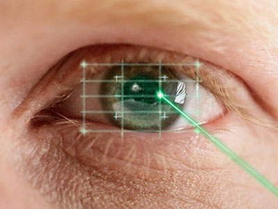 超聲乳化手術治療青光眼