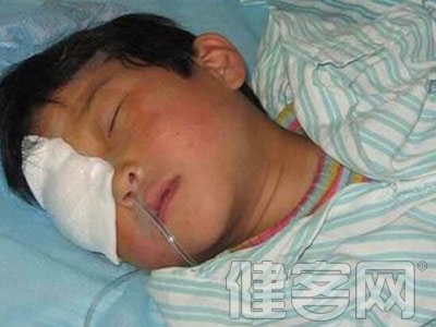 先天性白內障的手術治療
