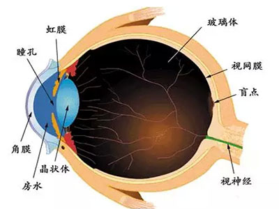 青光眼不治定致盲，一定要與這些食物絕交