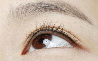 閉角型青光眼三期症狀表現