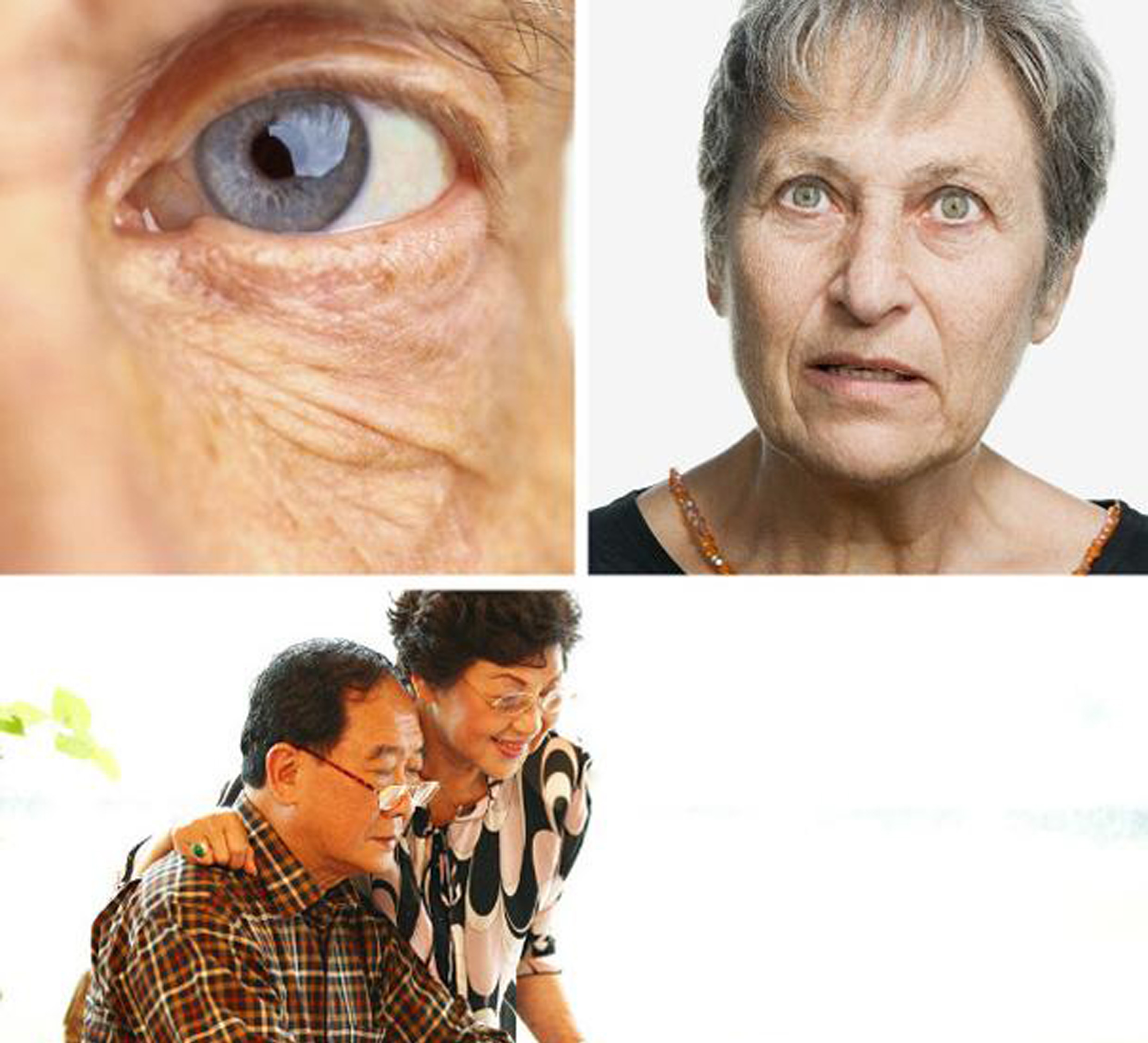季節交替需防青光眼 眼睛刺痛應及時就醫