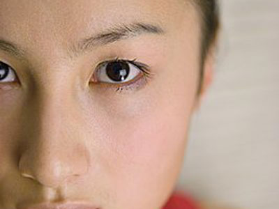 　　新加坡某醫院眼科中心高級顧問醫生倫承志表示，青光眼是一種視神經受損害，導致視野范圍減退甚至最終失明的眼科疾病。高眼壓是大部分人患青光眼的原因，但也有部分患者眼壓不高。青光眼分為閉角型青光眼和開角型青光眼，而閉角型青光眼可再分為急性和慢性。