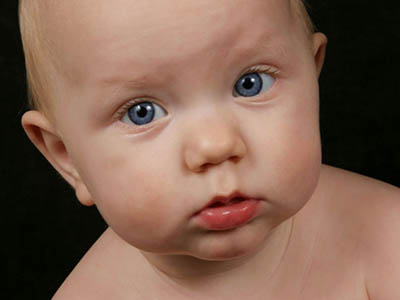 先天性青光眼：嬰幼兒是發病主體