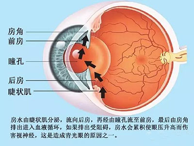治療青光眼 關鍵是眼壓