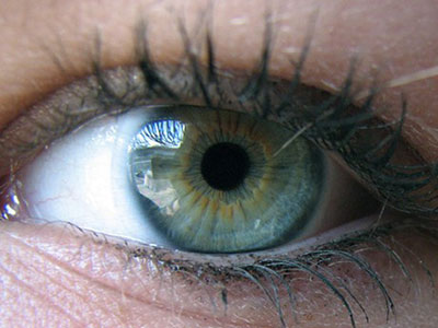 急性閉角型青光眼是怎麼回事？
