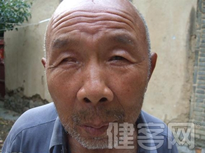 關於青光眼有哪些危害