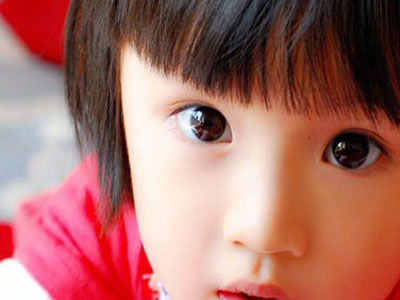 視力好的兒童也會患斜視 誘發斜視發生的原因