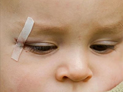 4歲兒童患白內障 病因竟是眼外傷