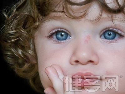 兒童眼外傷並發症之一白內障