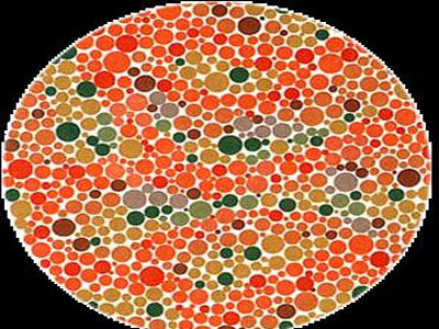 色盲的致病原因有哪些？色盲常用的檢查方法