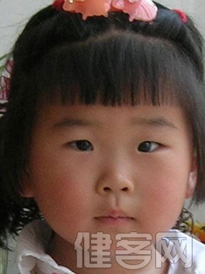 色盲色弱如何治療