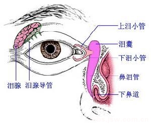 淚道狹窄的症狀與治療