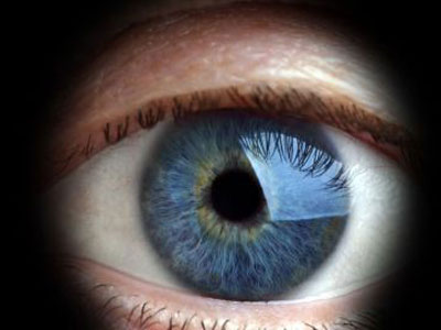 老年性黃斑變性直接導致失明