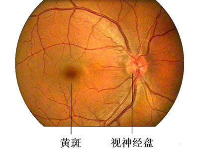 中老年人當心黃斑變性悄然而至