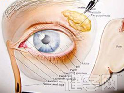 眼部腫瘤的症狀和食療法