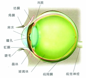 青光眼的患發要怎麼治療