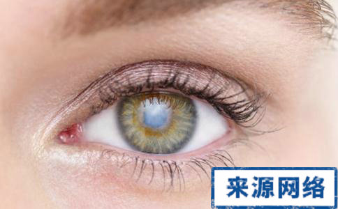 白內障 白內障的早期症狀 患有白內障