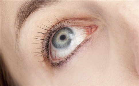 青光眼發病有哪些前兆 青光眼的早期症狀 治療青光眼的民間偏方