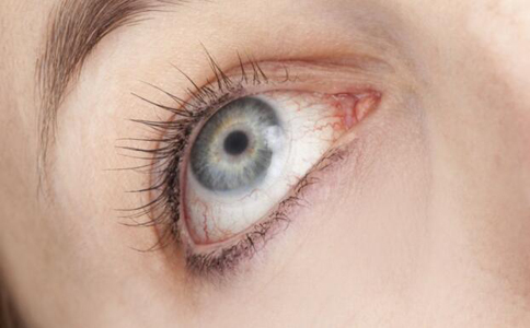 青光眼是如何引起的 青光眼有什麼症狀 青光眼的症狀有哪些