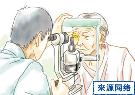 青光眼早期症狀 青光眼的症狀 青光眼有什麼症狀
