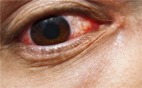 沙眼有什麼並發症 沙眼怎麼治療好 沙眼怎麼傳染