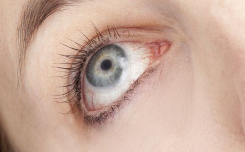 如何預防沙眼 沙眼的預防方法有哪些 沙眼怎麼護理