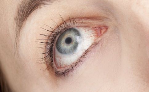 沙眼的危害有哪些 沙眼怎麼護理 沙眼會失明嗎