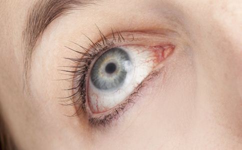 沙眼傳染途徑有哪些 沙眼是怎麼傳染的 怎麼預防沙眼