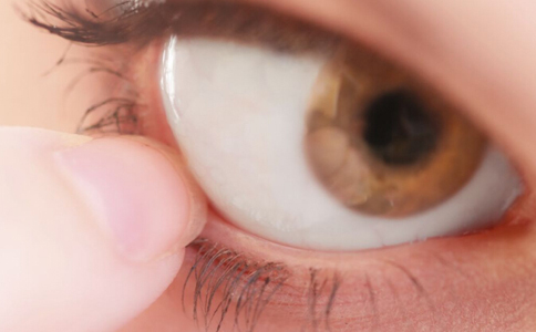 沙眼的表現 沙眼的症狀有哪些 沙眼會引起並發症嗎