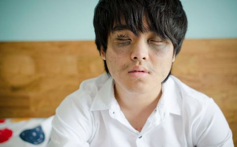 干眼症有什麼症狀 干眼症有哪些症狀 如何預防干眼症