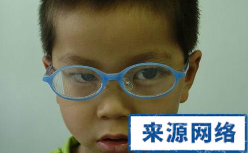 兒童斜視的症狀有哪些 兒童斜視有什麼危害 兒童斜視的病因是什麼