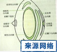 有色隱形眼鏡 色覺標准 先天性色盲 白內障