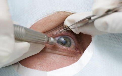 做完近視手術後要注意什麼 近視手術要注意什麼 做完近視手術的注意事項