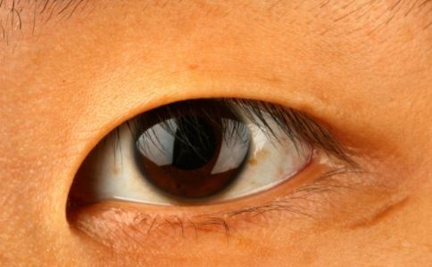 黃斑病變食療方 黃斑病變吃什麼食物 眼睛黃斑病變吃什麼好
