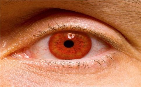 眼外傷的原因 眼外傷急救處理 怎樣保健眼睛