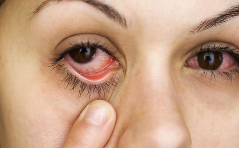 紅眼病能吃海鮮嗎 紅眼病不能吃什麼 紅眼病的飲食禁忌
