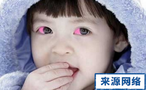 紅眼病怎麼傳染 紅眼病的傳染方式 紅眼病如何傳染