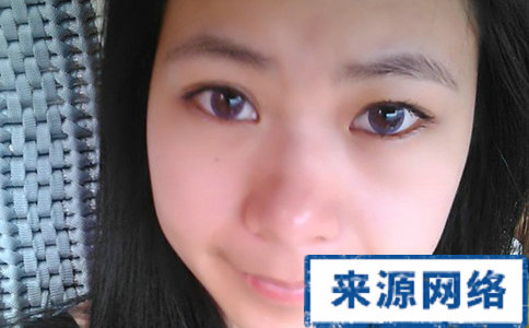 眼睛腫脹怎麼辦 如何預防眼睛腫 快速消腫眼睛有哪些方法