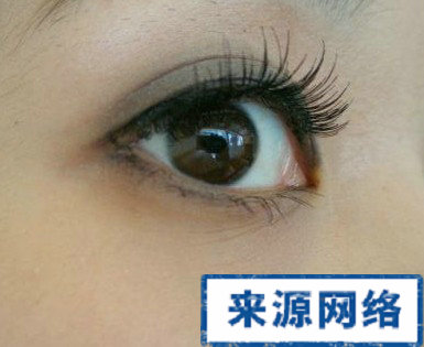 紅眼病 假睫毛 紅眼病的病因 紅眼病症狀