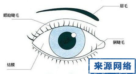 倒睫的原因 倒睫怎麼辦 倒睫治療方法