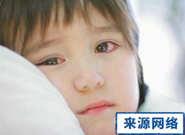 紅眼病的症狀 紅眼病怎麼傳染 紅眼病怎麼治