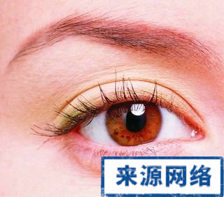 紅眼病的症狀 眼睛紅是紅眼病嗎 紅眼病怎麼治