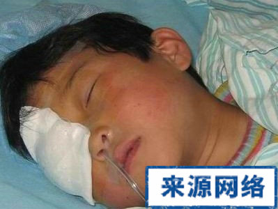 眼外傷 兒童 基礎知識 眼外傷預防 預防 玩具