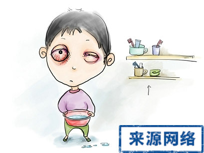 紅眼病 結膜大出血 慢性結膜炎 小兒感染紅眼病